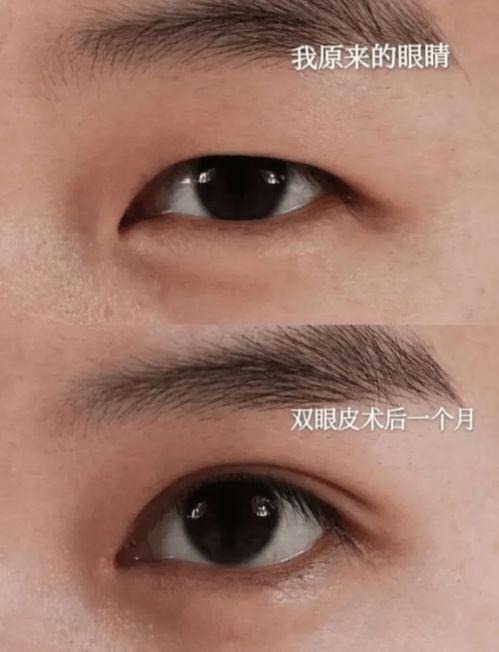 做过双眼皮的明星,双眼皮明星大盘点